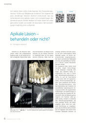 issueImage