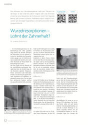 issueImage
