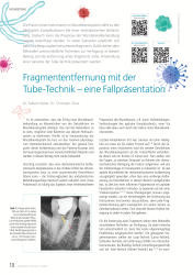 issueImage