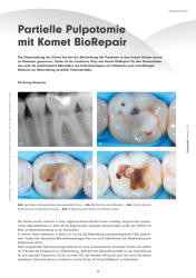 issueImage