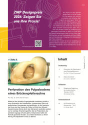issueImage
