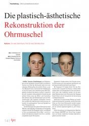 issueImage