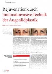 issueImage