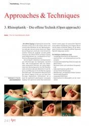 issueImage