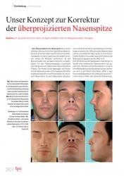 issueImage
