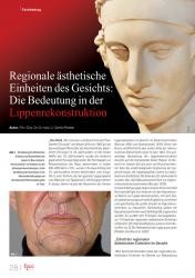 issueImage