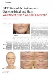 issueImage