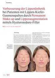 issueImage