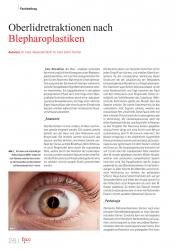 issueImage