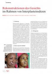 issueImage