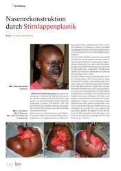 issueImage