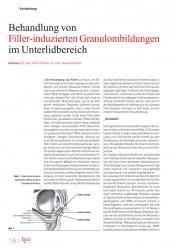 issueImage