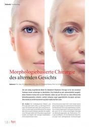 issueImage
