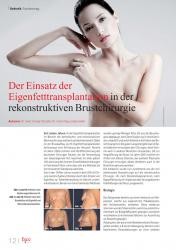 issueImage