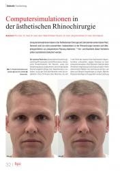 issueImage