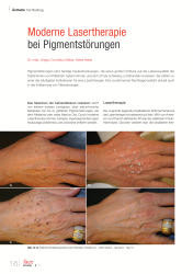 issueImage
