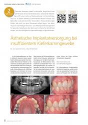 issueImage