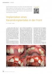 issueImage