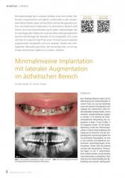 issueImage