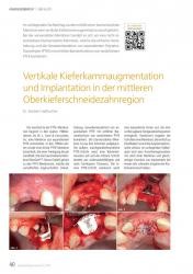 issueImage