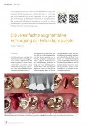 issueImage