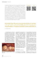 issueImage