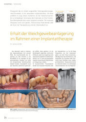 issueImage