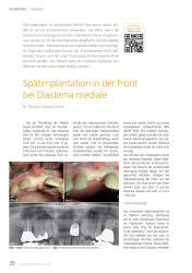 issueImage