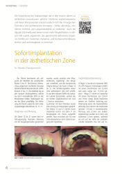 issueImage