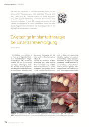 issueImage