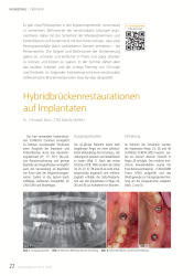 issueImage