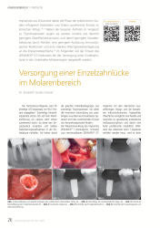 issueImage