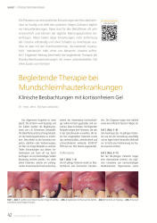 issueImage