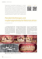 issueImage