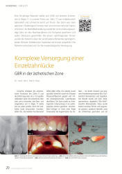 issueImage