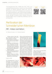 issueImage