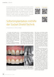issueImage