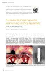 issueImage