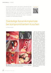 issueImage