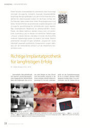 issueImage