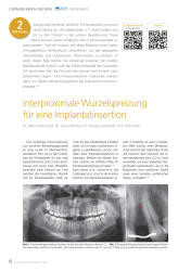 issueImage