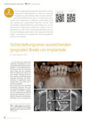 issueImage