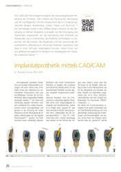 issueImage