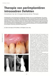 issueImage
