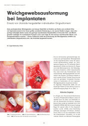 issueImage