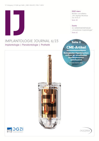 IJ Implantologie Journal