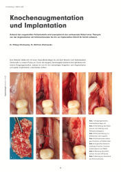 issueImage