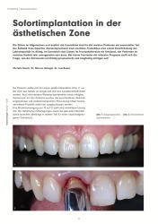 issueImage