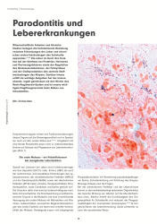 issueImage