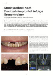 issueImage